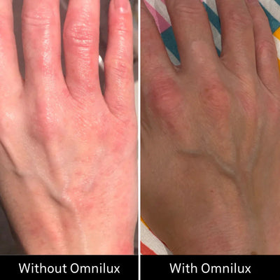 Omnilux Contour™ GLOVE