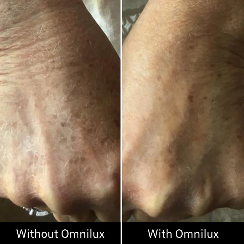 Omnilux Contour™ GLOVE