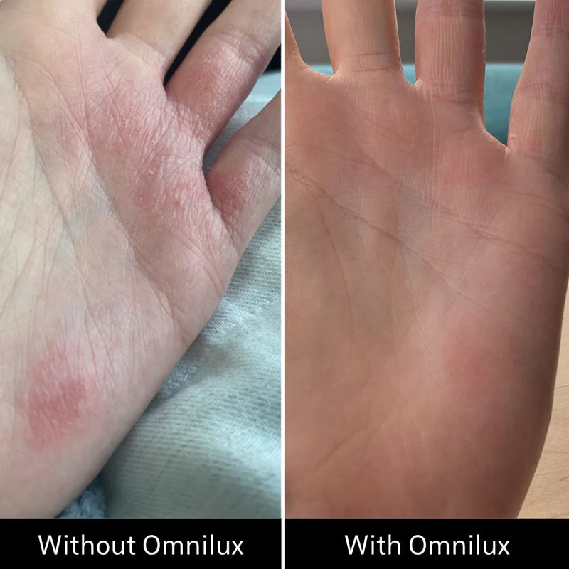 Omnilux Contour™ GLOVE