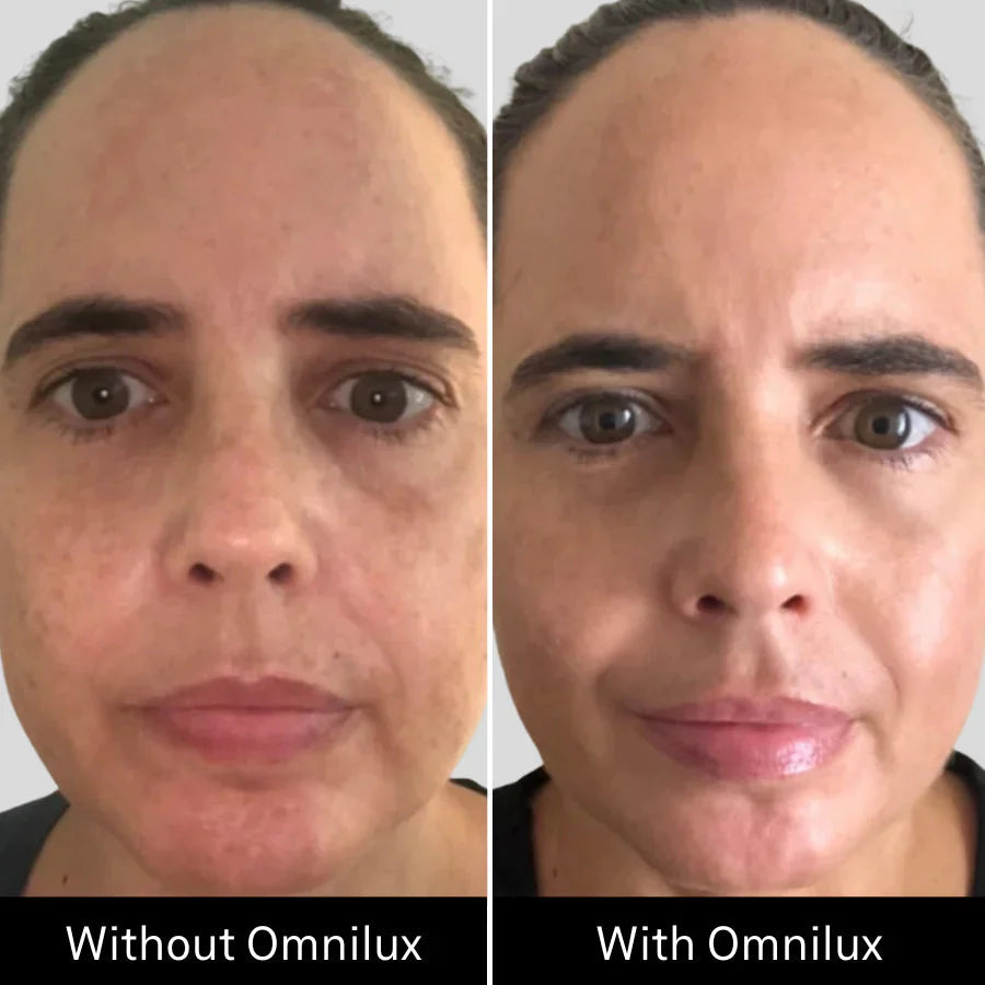 Omnilux Contour™ FACE